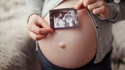 Przezierność karkowa - charakterystyka pomiaru, normy pomiaru, przyczyny powiększonego fałdu karkowego, dalsza diagnostyka