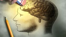 Choroba Alzheimera - przyczyny, objawy, leczenie, jak pomóc choremu