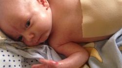 Krzyś o skórze delikatnej jak skrzydła motyla