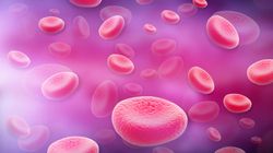 Nadpłytkowość (trombocytoza) - rodzaje, przyczyny, objawy, leczenie