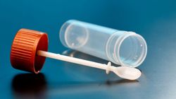 Krew w stolcu - objawy, przyczyny, badania