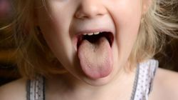 Angina - charakterystyka i przyczyny, objawy, leczenie, powikłania