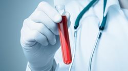 BUN, czyli azot mocznika - zastosowanie, normy, interpretacja