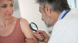 Cysta - przyczyny, rodzaje, leczenie