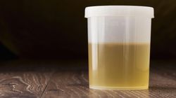 FSH (hormon folikulotropowy) - wskazania, normy, interpretacja