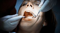 Próchnica - klasyfikacja, przyczyny, objawy, leczenie, profilaktyka, próchnica a prawidłowa higiena jamy ustnej, próchnica wczesna