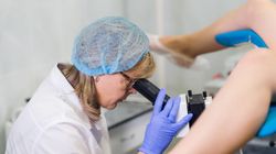 Badanie cytologiczne szyjki macicy