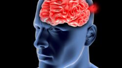 Tętniaki rozwijają się w ukryciu. Zobacz, dlaczego powstają