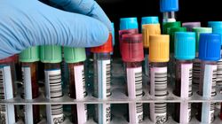 Badania krwi. Co możemy z nich wyczytać? #ZdrowaPolka