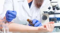 Uczulenie na kosmetyki - objawy, przyczyny i leczenie