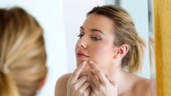 Trądzik - wizyta u dermatologa, najczęstsze pytania, dieta, antykoncepcja