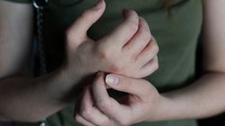 Pokrzywka alergiczna - objawy, przyczyny, diagnostyka i leczenie