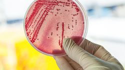 Badania bakteriologiczne - wskazania, pobranie próbki, etapy