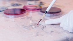 Diagnostyka białaczek - morfologia krwi, biopsja szpiku, badania cytogenetyczne