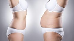 Oponka na brzuchu - u kobiet, dieta, ćwiczenia