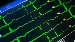 Interpretacja badania EKG serca