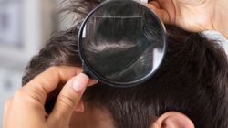 Wszawica - rodzaje, objawy, leczenie