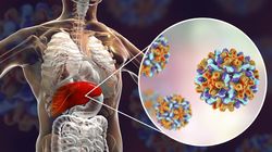 Wirusowe zapalenie wątroby - cichy zabójca, rodzaje, leczenie, szczepionka 