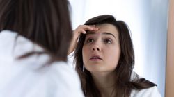 Trądzik - najczęściej zadawane pytania, trądzik mechaniczny