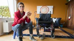 Demielinizacja - przyczyny, objawy, leczenie