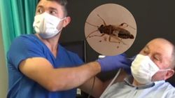 Brzęczenie w uchu nie dawało mu spokoju. Nie spodziewał się, co lekarz w nim znajdzie