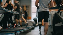 Hemimelia (wrodzona amputacja kończyn) - przyczyny, objawy, leczenie