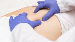 Przepuklina przeponowa - przyczyny, objawy i leczenie