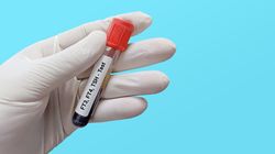 FT3 - cel i przebieg badania, wyniki