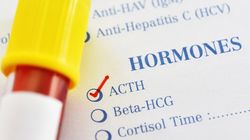 ACTH - wskazania, przebieg badania, interpretacja wyników