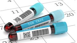 TSH - wyniki i interpretacja, skuteczność badania