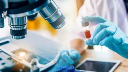 Wyniki badań krwi - erytrocyty, hemoglobina, leukocyty, limfocyty