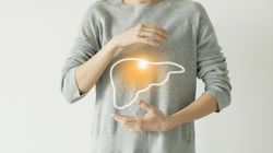 Ogniskowy rozrost guzkowy wątroby