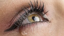 Zapalenie gruczołu łzowego - przyczyny, objawy i leczenie