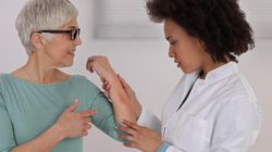 Łojotokowe zapalenie skóry a łysienie