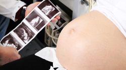 USG 3 trymestru - kiedy wykonać, jak przebiega i co wykrywa?