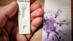 Co robić, gdy otrzymamy pozytywny wynik testu? Wyjaśniamy krok po kroku