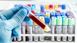 Neutrofilia i neutropenia - najczęstsze przyczyny. Czy to groźne?