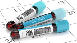 Norma TSH (badanie tarczycy) - badanie dla 20-latki, 30-latki, dla mężczyzn, dla kobiet w ciąży