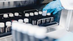 Hematospermia - przyczyny, objawy i leczenie