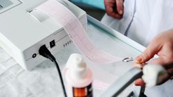 Bradyarytmie - przyczyny, objawy, rozpoznanie i leczenie