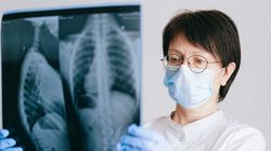 Płuca - budowa, funkcje, choroby, nowotwory płuc