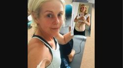 Myślała, że ma zespół jelita drażliwego. Okazało się, że to nowotwór. "Mój świat rozpadł się na kawałki"