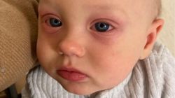 Taki może być efekt braku testów. Nie będziemy kojarzyć groźnych powikłań z wirusem