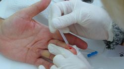 "Cichy zabójca". 120 tys. Polaków nie wie, że jest zakażonych. Choroba wyniszcza wątrobę, prowadzi do raka