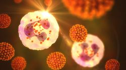 Neutropenia: objawy, przyczyny, stopnie i leczenie