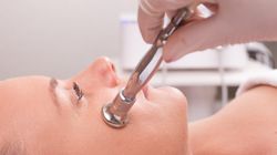 Mikrodermabrazja - co to jest, rodzaje, wskazania, przeciwwskazania, cena