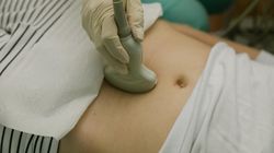 Tenesmus może być objawem raka jelit. Ale pojawia się też przy chorobach wenerycznych