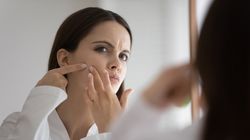 Wyciskanie wągrów - bezpieczeństwo, skutki, sposoby na pozbycie się zaskórników