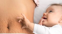 Rozstępy - charakterystyka, przyczyny, jak je usunąć, domowe sposoby na rozstępy