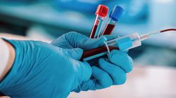 Morfologia krwi obwodowej - wyniki i normy, zastosowanie